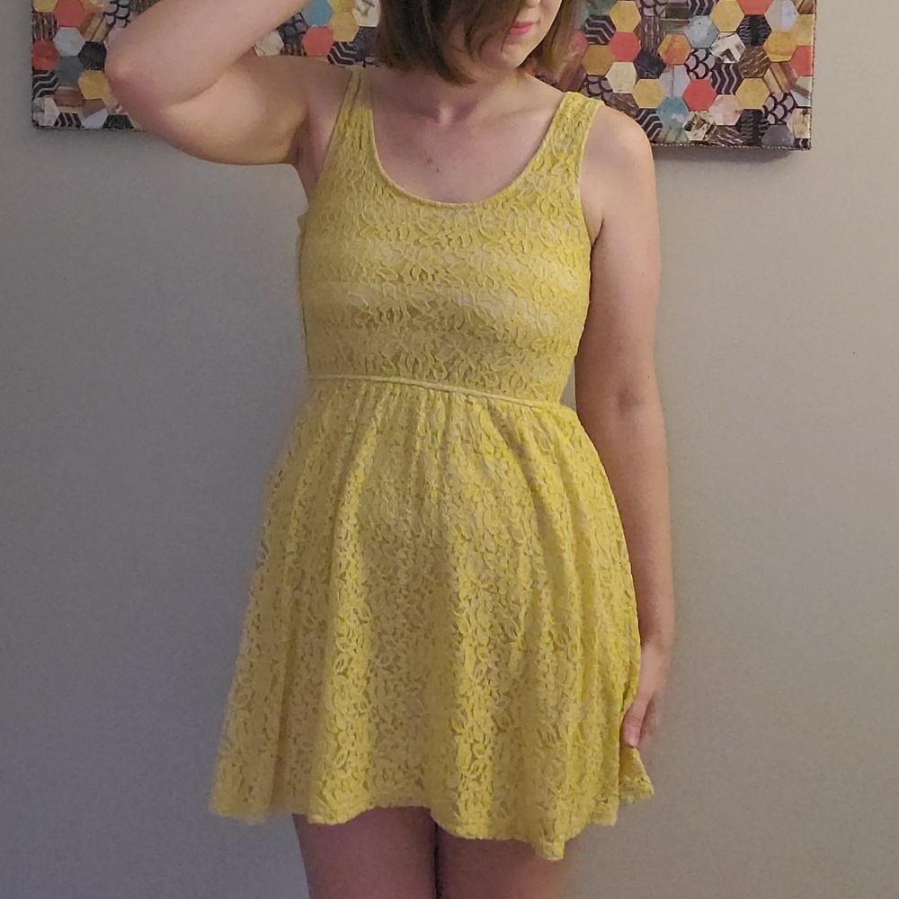 Yellow Lace & Striped Dress